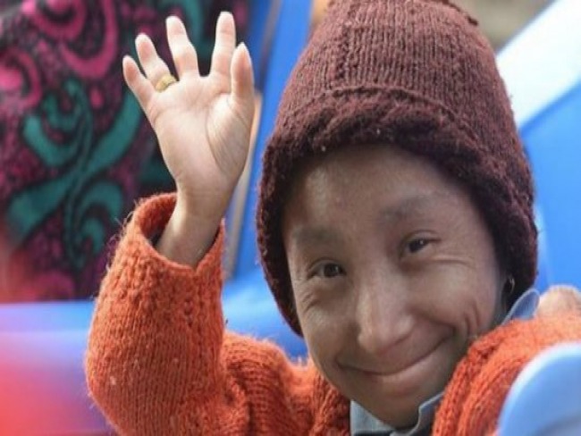 Menor homem do mundo morre, ao 27 anos, no Nepal