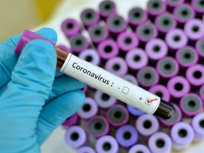 Cuba tem antiviral para tratar coronavírus e pode exportá-lo