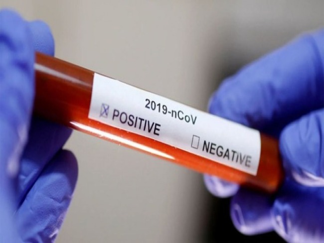 Tracunhaém: Médico de UBS testa positivo para o coronavírus