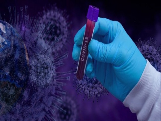 PE registra 54 mortes por coronavírus em 24 horas e chega a 803 óbitos
