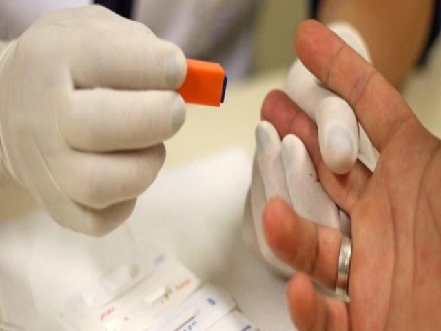 Ministrio da Sade orienta farmcias a realizar testes rpidos de HIV, hepatites virais, sfilis e ISTs