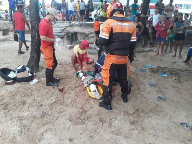 Homem atacado por tubaro em Pernambuco tem perna amputada