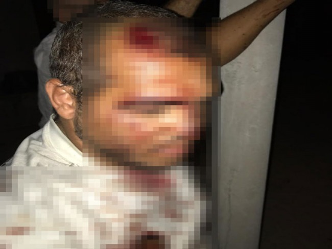 Comerciante fica ferido aps entrar em luta corporal com assaltantes na zona rural de Santaluz; concunhado dele leva tiro de raspo 