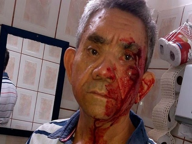 No quero mais dar aulas, diz professor agredido por aluno de 14 anos 