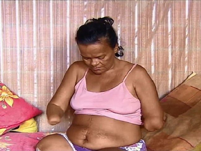 Mulher sem mos tem pedido de benefcio negado pelo INSS por no poder assinar papel