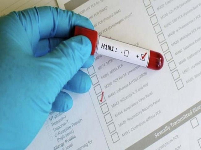 Exame confirma morte de idosa no Hospital Regional de Irec por gripe H1N1