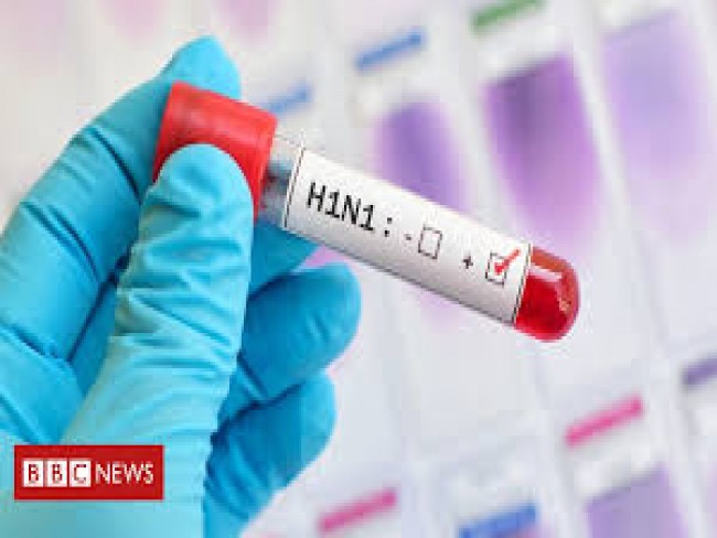 Secretaria de Sade confirma 1 caso de H1N1 em Campo Formoso