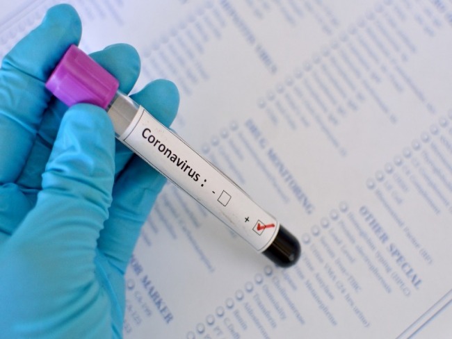 Serrolndia registra mais 4 casos positivos de COVID-19 e nmero agora  de 16