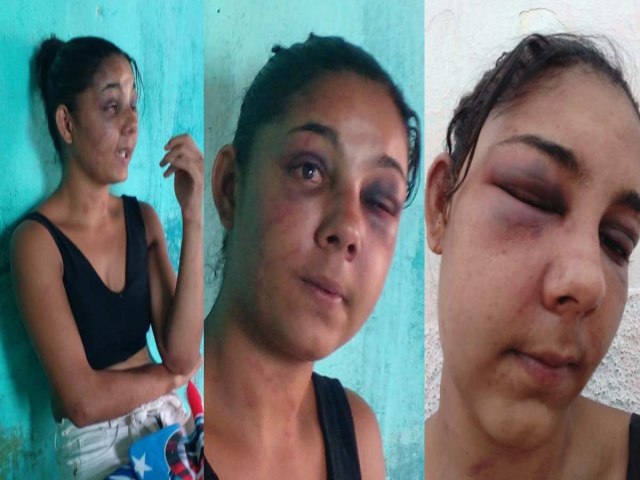 Mulher  brutalmente agredida pelo marido em Vrzea Nova