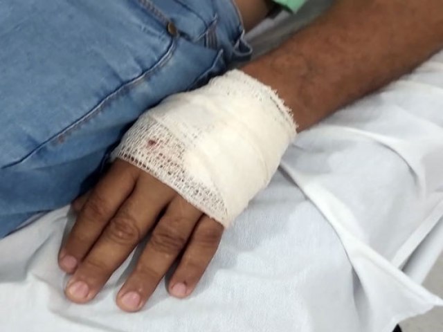 Agricultor tem mão ferida após ser atacado por jumento na zona rural de Queimadas