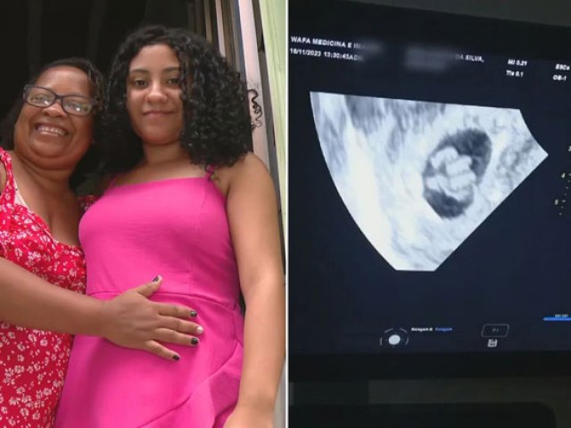 Jovem de 18 anos passa mal durante exame de ultrassom ao descobrir que está grávida de 5 bebês