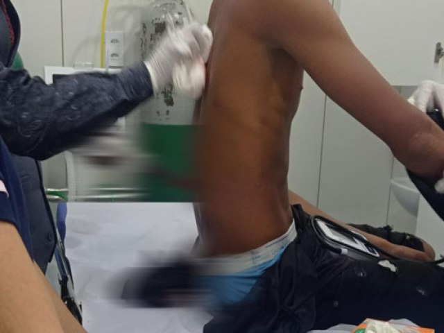 Adolescente de 13 anos  socorrido para hospital de Santaluz com faca cravada nas costas aps confuso em bar
