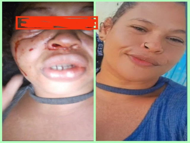 Mulher tem rosto deformado aps ser agredida por marido na Bahia