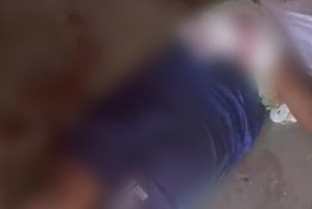 Menino de 12 anos � transferido com ferimentos graves ap�s fogo de artif�cio explodir na m�o em Concei��o do Coit�