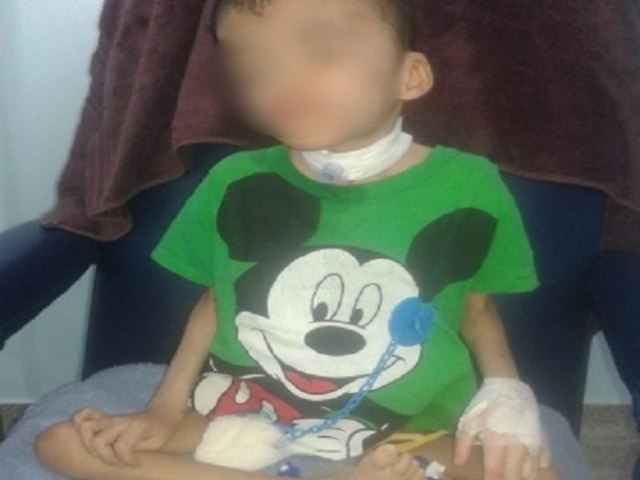 Euclides da Cunha (BA): Criança  que sofreu parada respiratória e precisa ser transferida para UTI espera regulação do estado há 7 dias