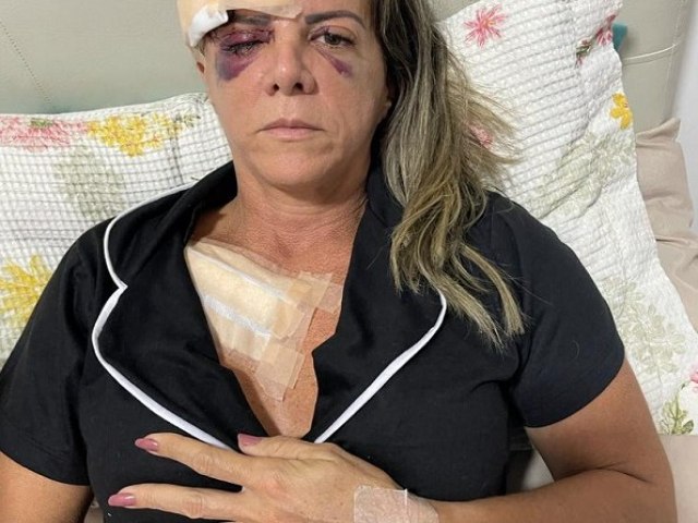 Petrolina (PE): Família de mulher atacada por Pitbull emite nota de agradecimento; dona do animal já foi identificada