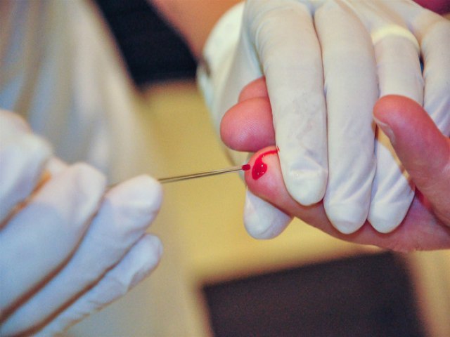 No Dia Mundial de Luta contra Hepatites Virais, infectologista ressalta importância do teste para detectar doença