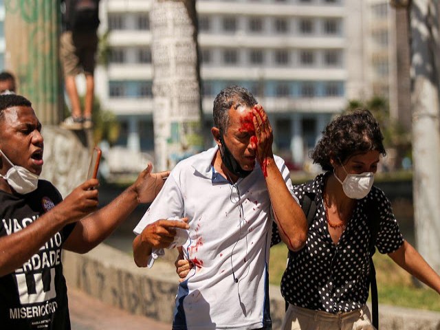 Atingido por bala de borracha em ato contra Bolsonaro no Recife, homem que no estava em protesto perde olho