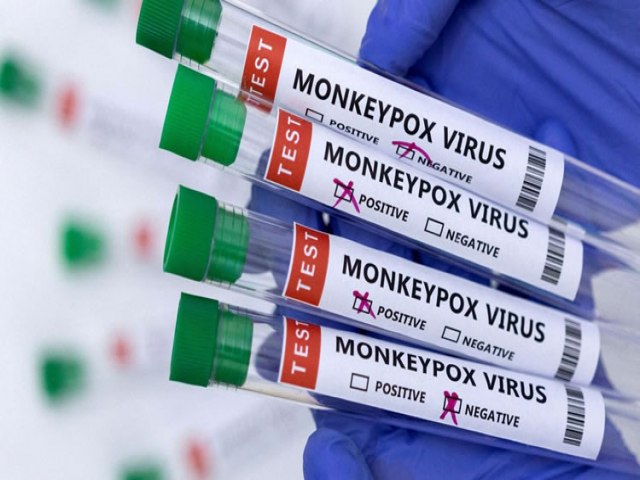 Casos de varíola dos macacos chega a 76 em todo o país