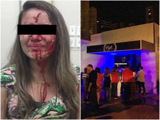 Estudante é atingida com garrafa na testa durante briga no 'Café Maison'