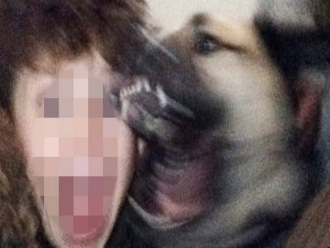 Menino leva 21 pontos no rosto ao ser mordido por cão enquanto tirava selfie