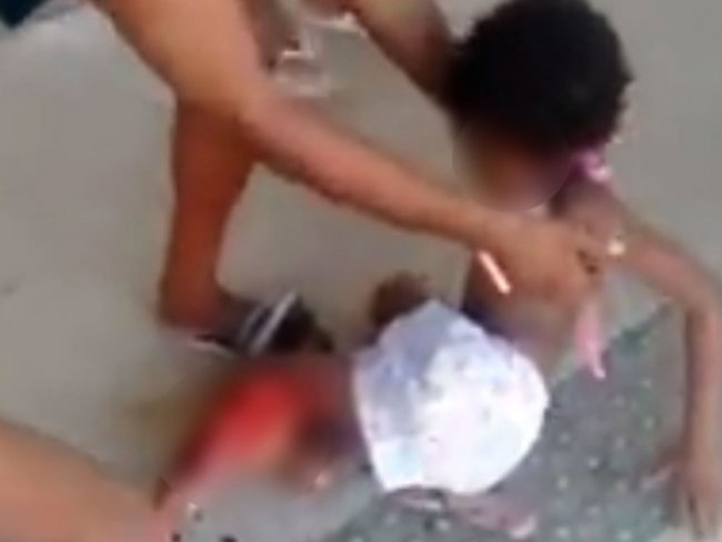 Criança tem perna dilacerada após cair de plataforma de ônibus