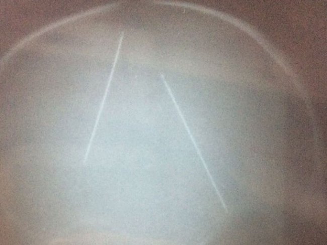 Raio-X mostra agulhas na cabeça de bebê vítima de suposto ritual