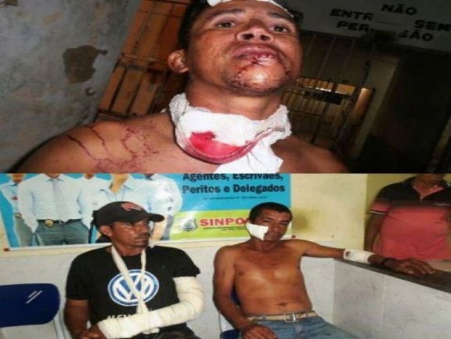 Discussão após bebedeira deixa três homens feridos no Piauí