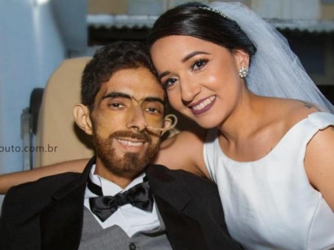 Morre paciente que ganhou festa de casamento em hospital de Maceió