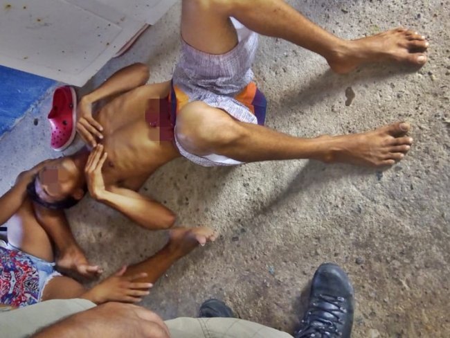 Adolescente deixa as vísceras do irmão expostas após briga, em Parnaíba