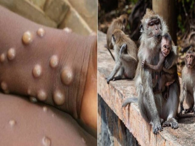 Sesapi realiza capacitação de profissionais após crescimento de casos da Varíola dos Macacos