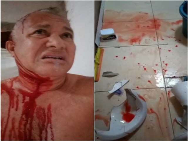 Jornalista quebra vaso sanitário com a cabeça em grave acidente doméstico em Teresina