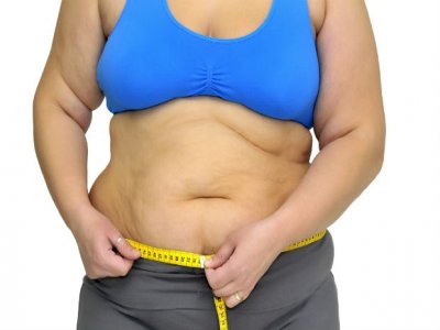 45% dos brasileiros se dizem obesos; só 16% fazem dieta