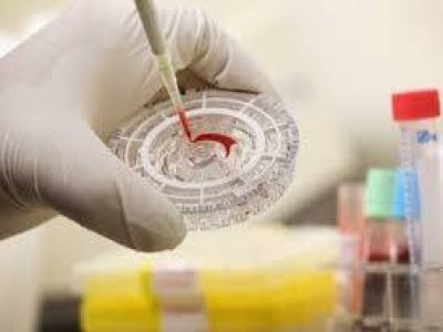 Doadores mostram interesse em financiar tratamento sanguíneo contra o ebola