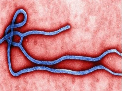 Médico é diagnosticado com ebola em Nova Iorque