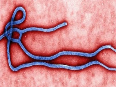 Ebola causou 5.420 mortes, afirma OMS