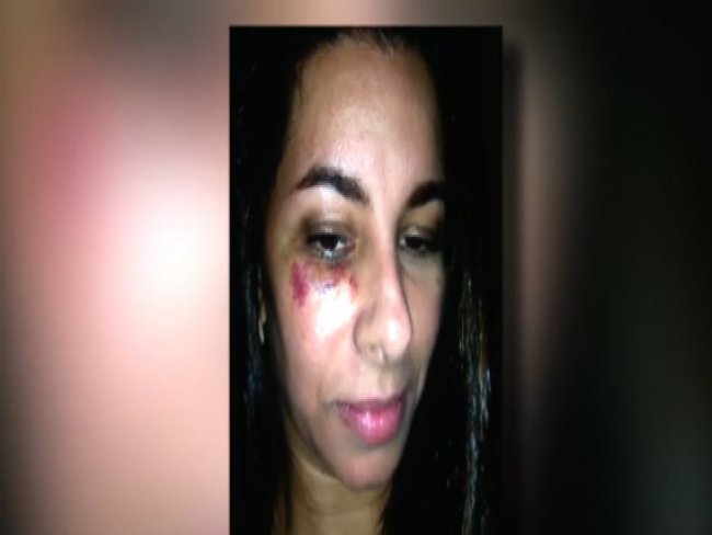 Cantora é espancada após reagir a assalto no Recife
