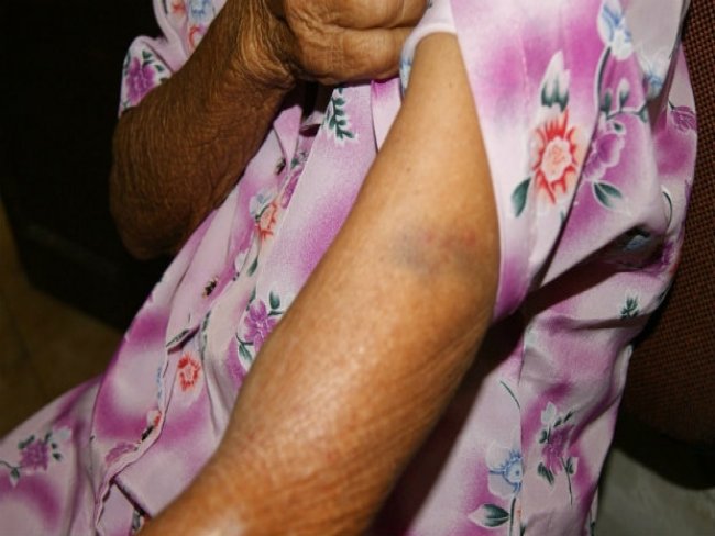 Idosa de 109 anos é espancada por menores durante assalto em Caruaru