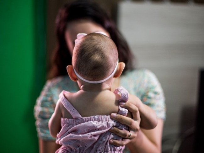 Governo corrige erro e reduz total de bebês com microcefalia no estado