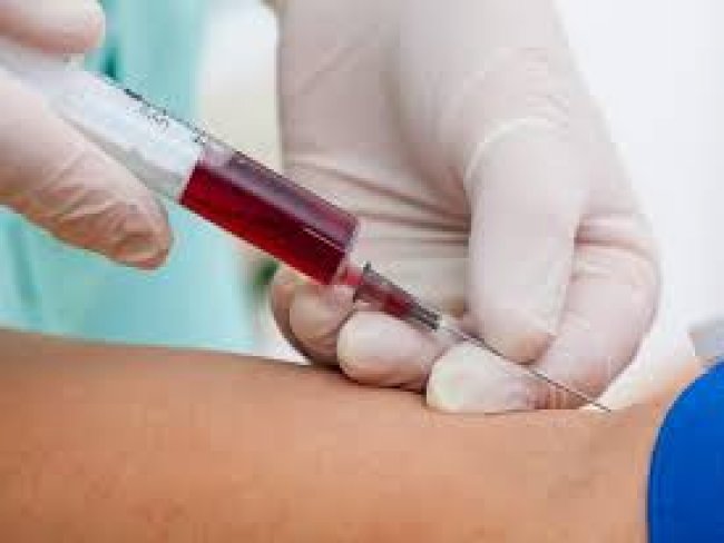 J  possvel fazer exames de sangue sem fazer jejum; entenda