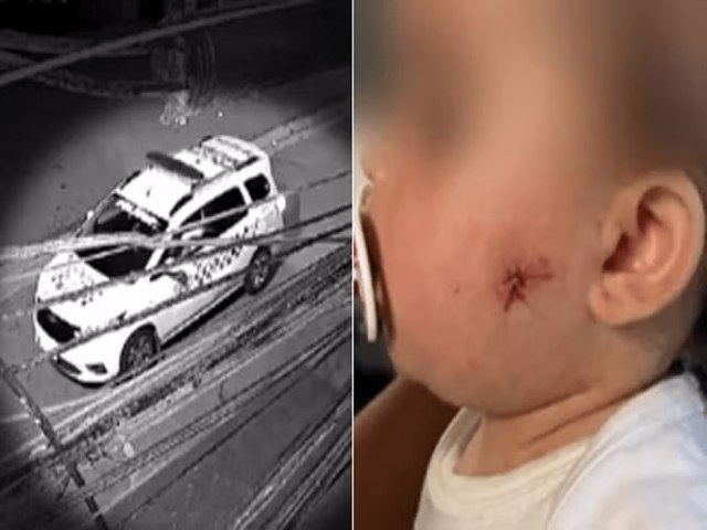 Vdeo: PM atira em rosto de menina de 1 ano com arma de airsoft na Zona Leste de SP