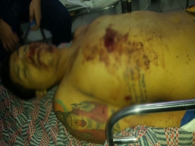 Acusado de matar policial civil  morto durante confronto com policiais