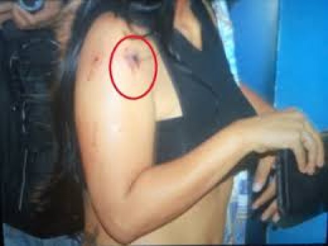 Petrolina PE: Mulher baleada em assalto na Vila Esperana.