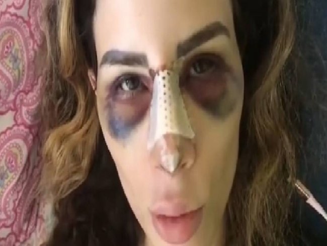 Camila Uckers choca fs com resultados desastrosos de cirurgias