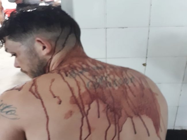 Estudante acusa policiais militares de agresso,em Salgueiro, no Serto de PE