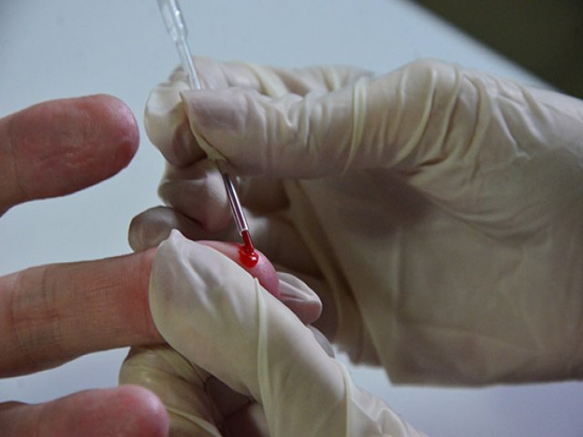 Rio Grande do Norte registra 6.470 casos de AIDS em dez anos