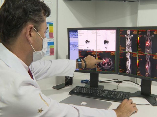 Cncer de prstata tem novo tratamento com radioterapia reduzida