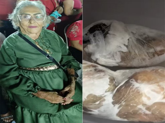 Idosa com suspeita de intoxica��o por ciguatera morre ap�s quase um m�s internada no RN