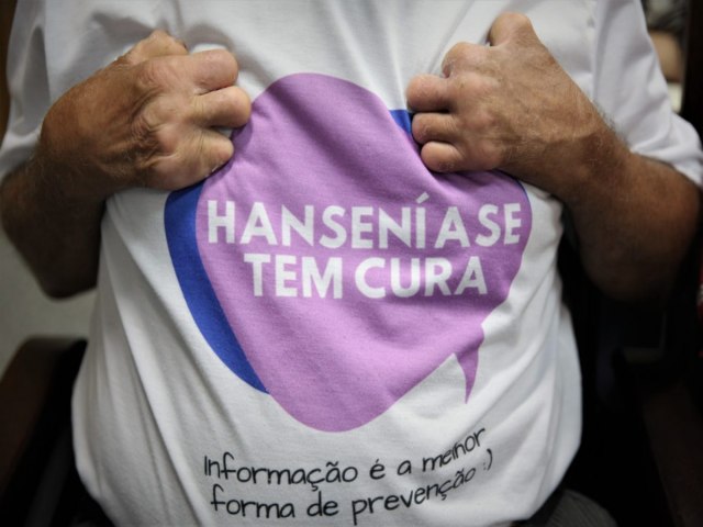 Janeiro Roxo: Acre registrou mais de 100 casos de hansenase em 2023, diz Sade