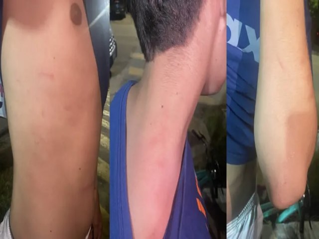 Militares de Xapuri so acusados de agresso contra dois jovens aps abordagem